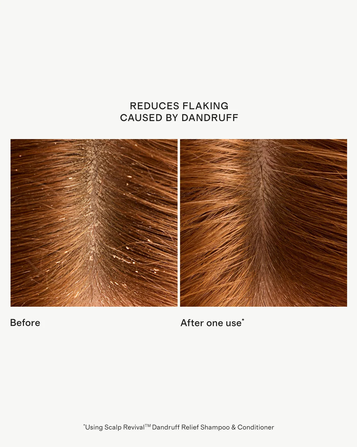 Scalp Revival™ Dandruff Relief Shampoo 8.4oz by Briogeo - One Size / No Color